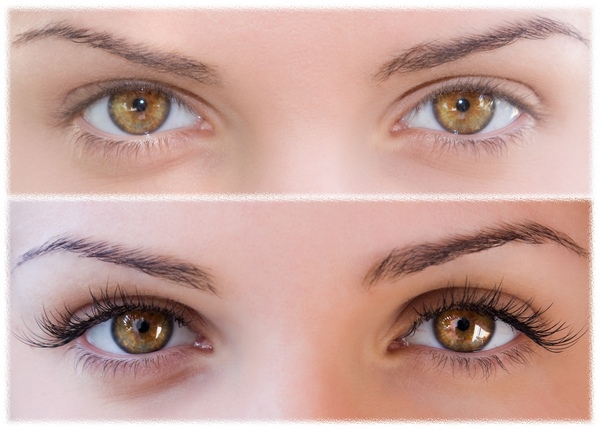 Eyelash implant what is